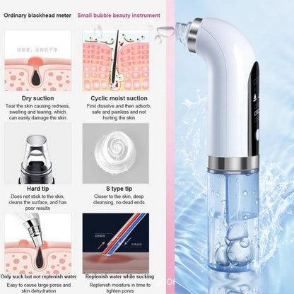 Electric Blackhead Vacuum Remover - premium - Trendyvice worldwide